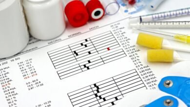 how to test for homorzopia